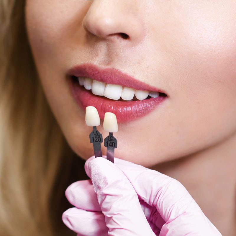veneers being held up in front of a woman's teeth